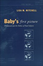 Baby's First Picture: Ultrasound and the Politics of Fetal Subjects
