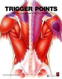 Trigger Points: Understanding Myofascial Pain and Discomfort