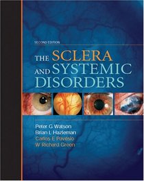 Sclera & Systemic Disorders