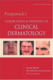 Fitzpatrick''s Color Atlas  Synopsis of Clinical Dermatology