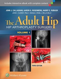 The Adult Hip: Arthroplasty and Its Alternatives (2 Vol)