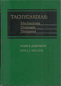 Tachycardias: Mechanisms, Diagnosis, Treatment