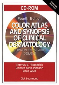 Color Atlas and Synopsis of Clinical Dermatology: Common and Serious Diseases