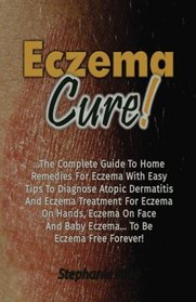 Eczema Cure!: The Complete Guide To Home Remedies For Eczema With Easy Tips To Diagnose Atopic Dermatitis And Eczema Treatment For Eczema On Hands, Eczema On Face And Baby Eczema... To Be Eczema Free
