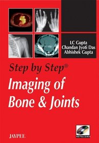 Step by Step Imaging of Bone and Joints