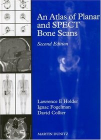 Atlas of Planar and SPECT Bone Scans