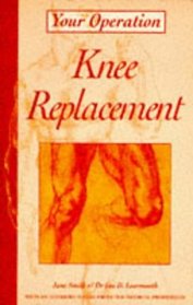 Knee Replacement (Your Operation S.)