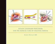 Bassini Landmark Procedure for the Radical Cure of Inguinal Hernia