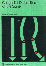 Congenital Deformities of the Spine