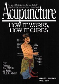 Acupuncture : How It Works, How It Cures