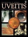 Uveitis An Illustrated Manual