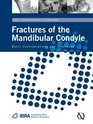 Fractures of the Mandibular Condyle Basic Considerations and Treatment