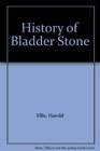History of Bladder Stone