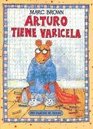 Arturo tiene varicela / Arthur's Chicken Pox