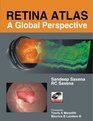 Retina Atlas A Global Perspective