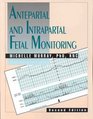 Antepartal  Intrapartal Fetal Monitoring