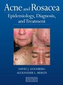 Acne and Rosacea Epidemiology Diagnosis and Treatment