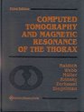 Computed Tomography and Magnetic Resonance of the Thorax