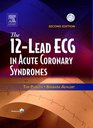 The 12Lead ECG in Acute Coronary Syndromes Text and Pocket Reference Package