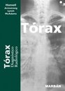 Torax  Diagnostico Radiologico