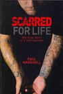 Scarred for Life The true story of a selfharmer