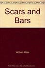 Scars  Bars