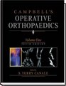 Campbell's Operative Orthopaedics Four Volume Set