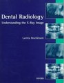 Dental Radiology Understanding the XRay Image