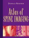 Atlas of Spine Imaging