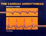 The Cardiac Arrhythmias