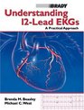 Understanding 12Lead EKGs A Practical Approach