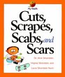 Cuts Scrapes Scabs and Scars