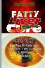 Fatty Liver Cure Best Tips on Fatty Liver Treatment Fatty Liver How To Reverse It Today