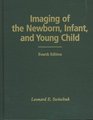 Imaging of the Newborn Infant and Young Child