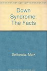 Down Syndrome The Facts