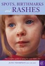 Spots Birthmarks and Rashes The Complete Guide to Caring for Your Child's Skin