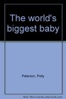 The world's biggest baby