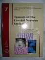 Tumors of the Central Nervous System