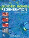 20 Years of Guided Bone Regeneration in Implant Denistry