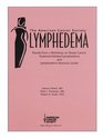 Lymphedema Handbook Rusults of a Workshop on Breast Cancer TreatmentRelated Lymphedema and Lymphedema Resource Guide
