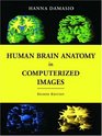 Human Brain Anatomy In Computerized Images