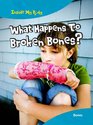 What Happens to Broken Bones Bones