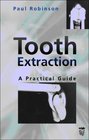 Tooth Extraction A Practical Guide