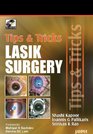 Tips and Tricks Lasik Surgery