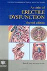 An Atlas of Erectile Dysfunction Second Edition