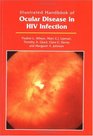 Illustrated Handbook of Ocular Disease in HIV Infection