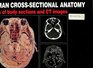 Human CrossSectional Anatomy Atlas of Body Sections and Ct Images