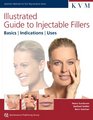 Illustrated Guide to Injectable Fillers Basics Indications Uses