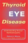 Thyroid Eye Disease Understanding Graves Ophthalmopathy