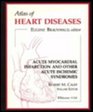 Atlas of Heart Disease Acute Myocardial Infarction  Other Acute Ischemic Syndromes Volume 8